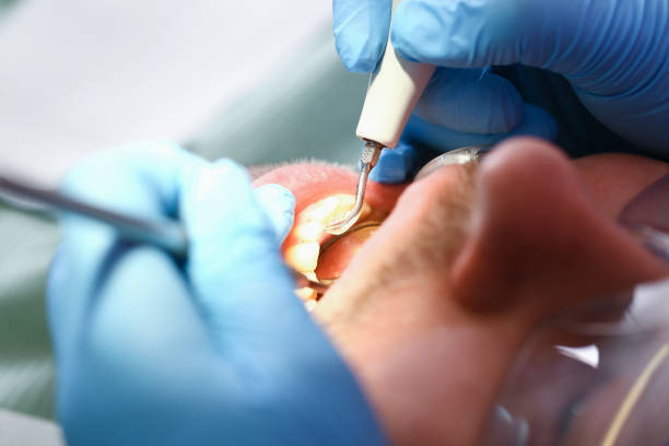 Best Knocked-Out Tooth Emergency  in Willmar, MN